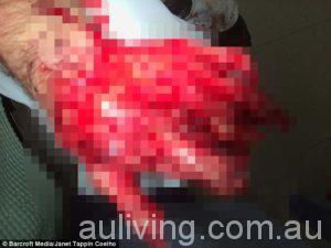 406E4E2C00000578-4519336-Horrifying_Carlos_said_his_hand_was_totally_mutilated_in_the_acc-a-45_1495374207543