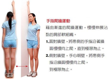 Image result for 肩周炎图片
