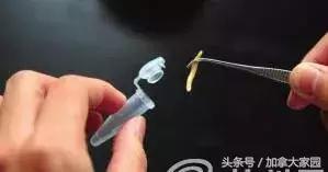 這6年，我生不如死！只是因為吃了這條魚……