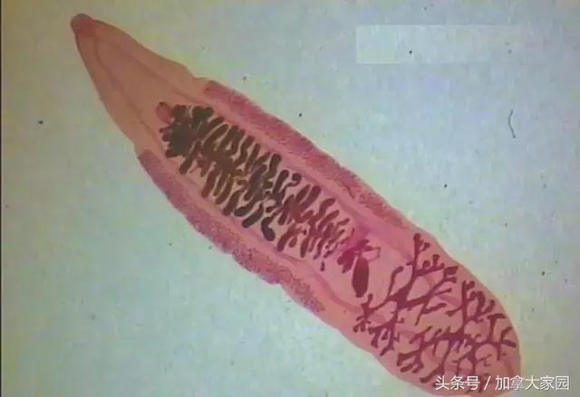 這6年，我生不如死！只是因為吃了這條魚……