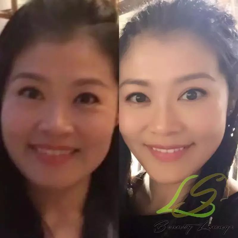 https://mmbiz.qlogo.cn/mmbiz_jpg/XIo5icAdibUPIZA8g4hqIzbT1g6lkKyibwohibJjibAPqqibTzQAOS8Mod3mYm3UHGMOA4SUY3osSzshDBcT4KZxkgSg/0?wx_fmt=jpeg