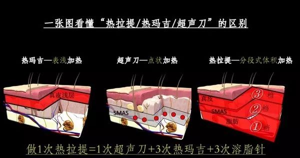 https://mmbiz.qpic.cn/mmbiz_jpg/XIo5icAdibUPIZA8g4hqIzbT1g6lkKyibwoibh57ketPQAb8gBzVTGR8uI4icKgUGwdN5xYibcrR5iceMteabrdicicN5PQ/0?wx_fmt=jpeg