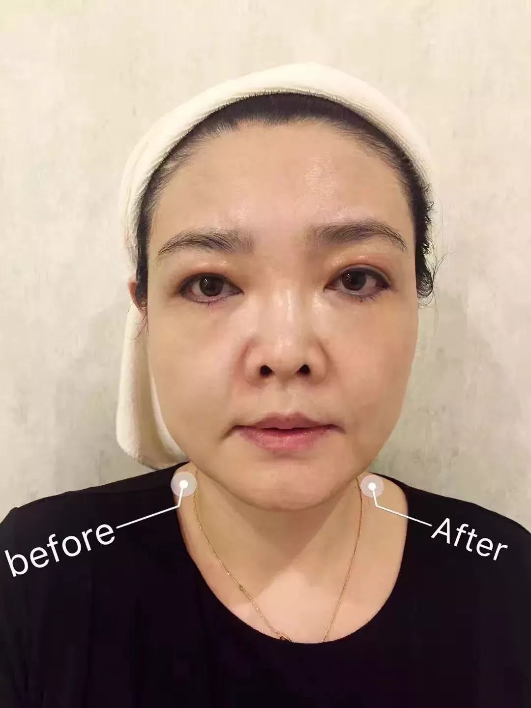 https://mmbiz.qpic.cn/mmbiz_jpg/XIo5icAdibUPIZA8g4hqIzbT1g6lkKyibwoY0hLYpbp0HCtfw46CekIVhvOBkib6txh6d0FQLgsNwlN8SOKVdsoJvg/0?wx_fmt=jpeg