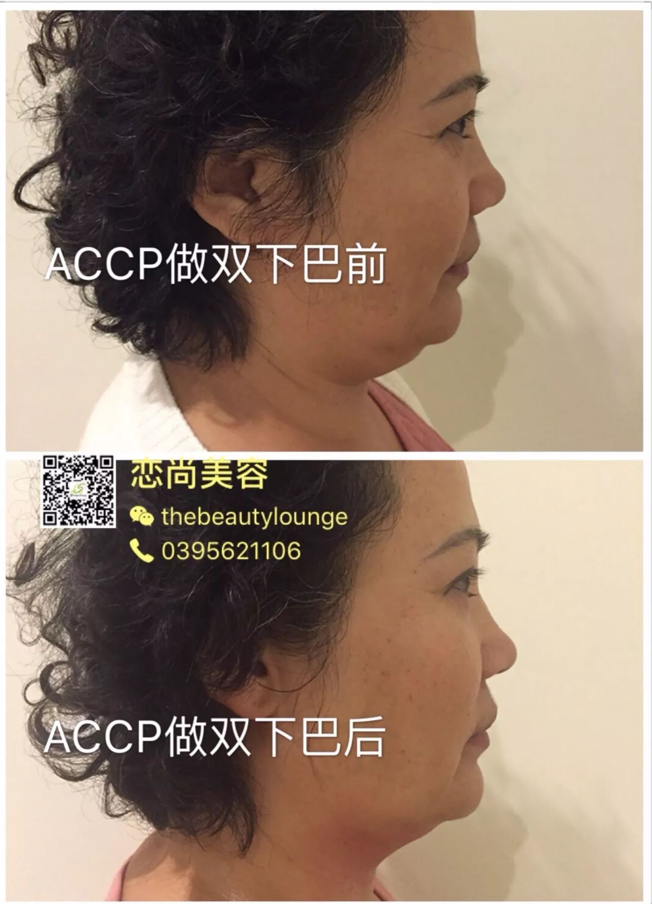 https://mmbiz.qpic.cn/mmbiz_jpg/XIo5icAdibUPIZA8g4hqIzbT1g6lkKyibwoDytE3icxkVp5bibMPJQaPUXArxkrd4TK7MEB3iaKm0h7qfKJcYKYmJK0w/0?wx_fmt=jpeg