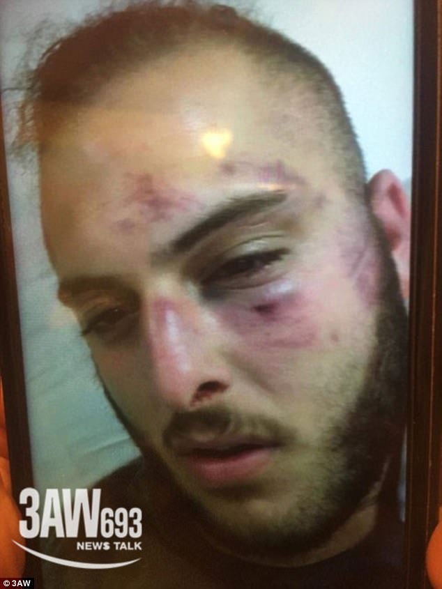 Video filmed on a guest's mobile phone shows both male and female passengers erupt into an all-in brawl as cruise security attempted to intervene, leaving some victims with savage bruises and cuts