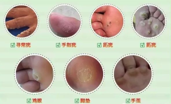 https://mmbiz.qpic.cn/mmbiz_png/XIo5icAdibUPK4EQv0wMDLCNC6bkaQIkda7gic3dk629ogtKJL7hMia2nFLM9cSu5xnxK1B8hpgHodKkdIgTP4BneQ/640?wx_fmt=png