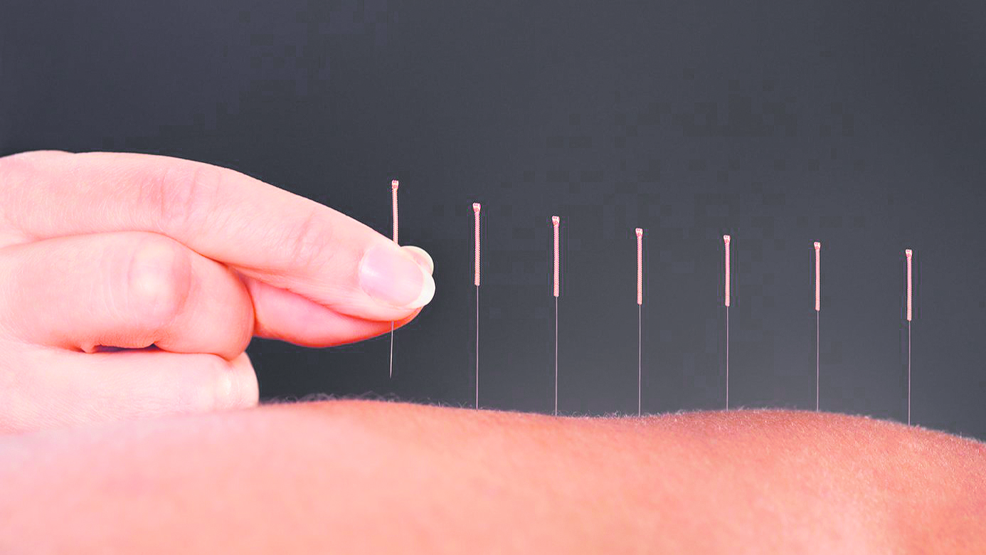 Z:\603-20180714\Final\B Section\B22-26 health\acupuncture.jpg