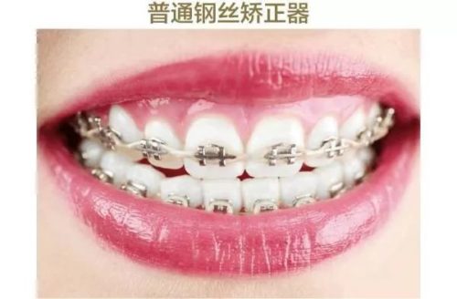 https://mmbiz.qpic.cn/mmbiz_jpg/XIo5icAdibUPLMAxXOR1srTjs9vPGeicsU8UZVPHekiaDcKl8fSicWBqphaiaYyESIqodnZUHWNJmNdCt1BNzf19zzOQ/640?wx_fmt=jpeg