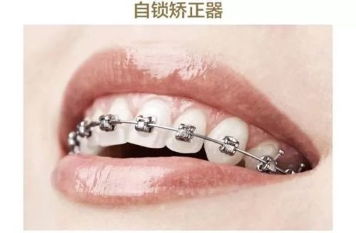https://mmbiz.qpic.cn/mmbiz_jpg/XIo5icAdibUPLMAxXOR1srTjs9vPGeicsU8onKiakBObymmywUS95kIKNmISicN9ZmmxdriaR9LNwHBNYAeRwhvFZzeg/640?wx_fmt=jpeg
