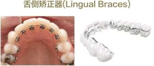 https://mmbiz.qpic.cn/mmbiz_jpg/XIo5icAdibUPLMAxXOR1srTjs9vPGeicsU8NJIuVBx5vTJZhJQyDSO0GKtr5jkPR78YGqeOmvvO3Ad3h4uK3fYQ6w/640?wx_fmt=jpeg
