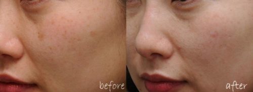 https://mmbiz.qpic.cn/mmbiz_png/XIo5icAdibUPLlfqBfu8r6JfnFFyVVyey2VRha3kRf38k08ZGeU1ibFb8psxb7Mr6Kt9v5gRzcoP4G0d3o2b8qSibg/640?wx_fmt=png