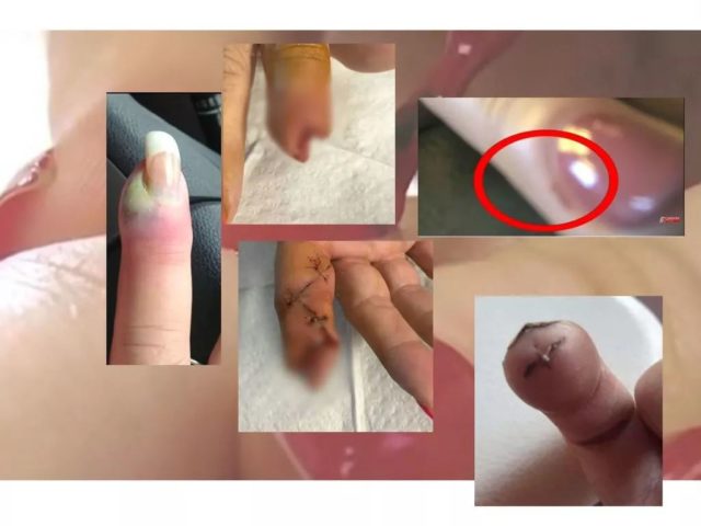 https://mmbiz.qpic.cn/mmbiz_jpg/XIo5icAdibUPIgiaia8ccok14etpiaAO4u968ia0Pxfhs3sZOEc78W91XKhhe9ziciaKnTo1LHa5c2FibyCdyiaz41GXqdFw/640?wx_fmt=jpeg