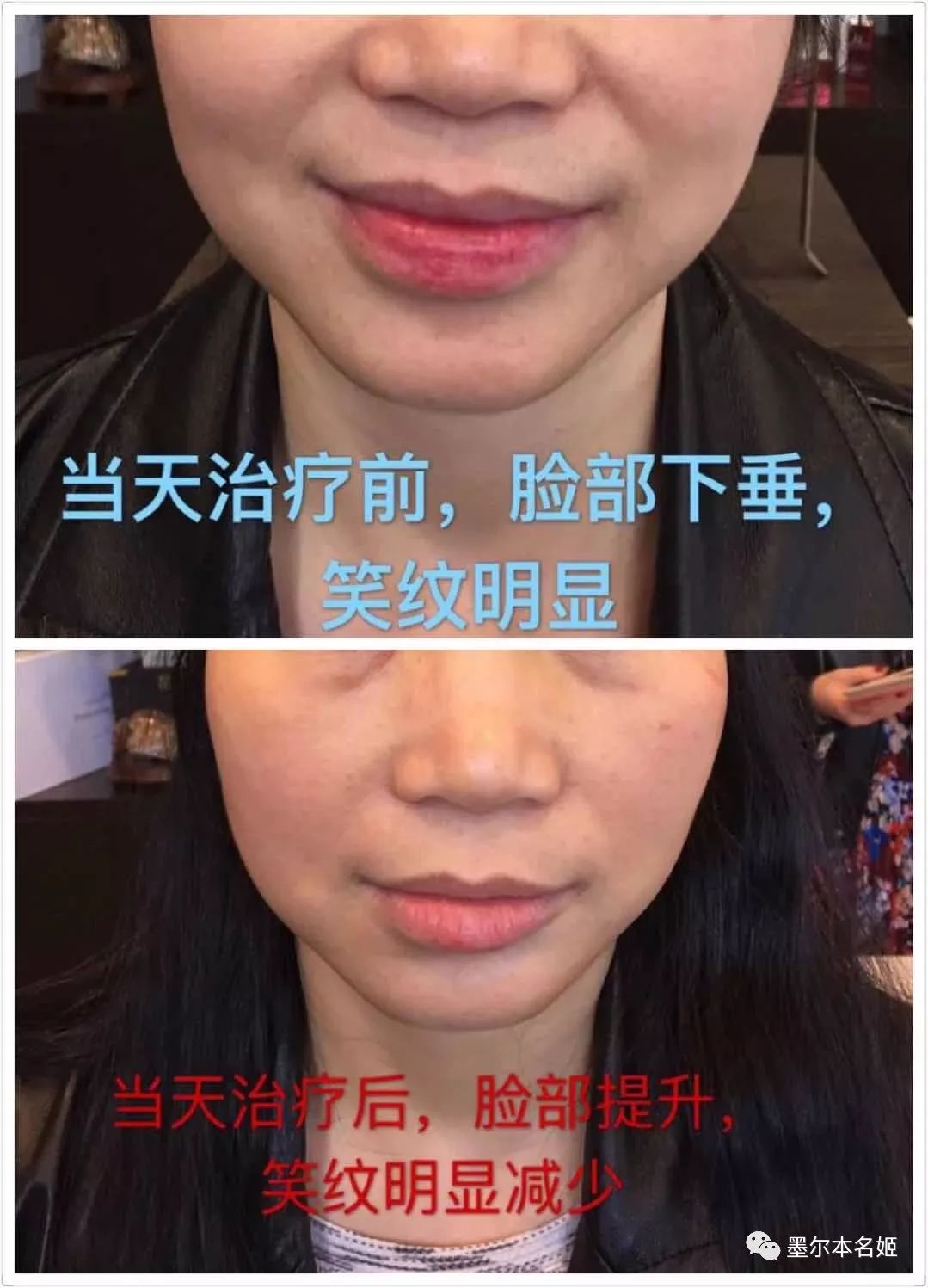 https://mmbiz.qpic.cn/mmbiz_jpg/aCuH30YtMugj97qfAbFce9fyZiaCzKGeB7VA0IUNAFNAWdbrQrZrGBoQDrt5gibX2PuQQPLR22esl8VQbrvibdHiaQ/640?wx_fmt=jpeg