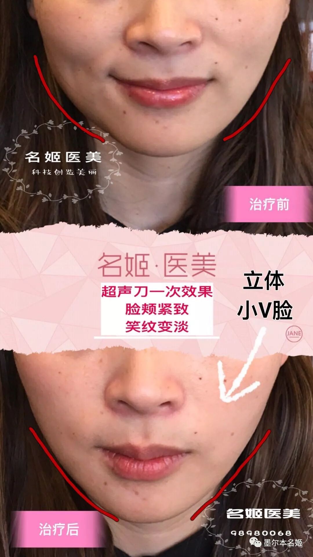 https://mmbiz.qpic.cn/mmbiz_jpg/aCuH30YtMugj97qfAbFce9fyZiaCzKGeBaNsh3oam1WsBC2MjgaHBmpuGLFcN74DPx6JJWx4xW0BfVtRhvFj6Dg/640?wx_fmt=jpeg