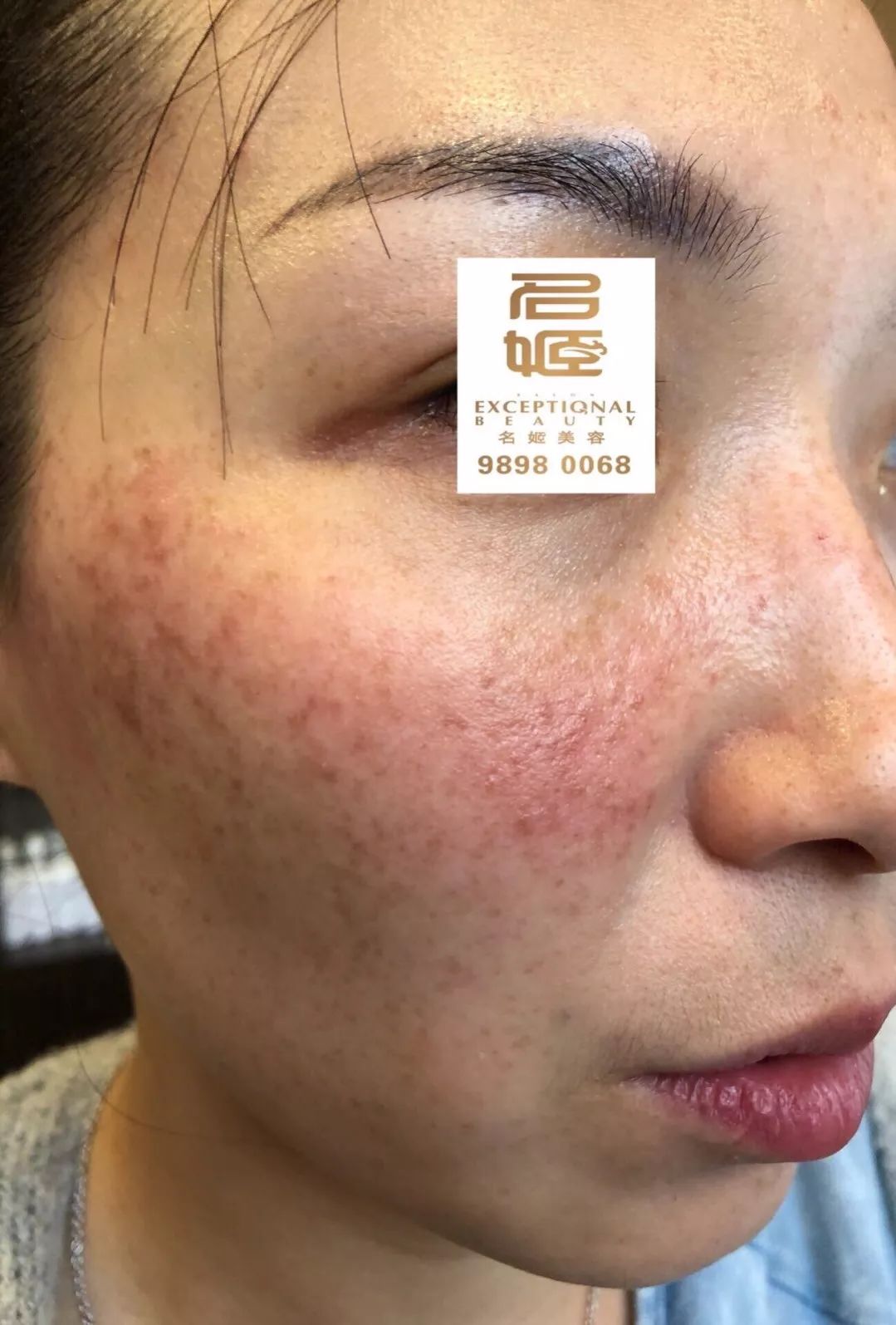 https://mmbiz.qpic.cn/mmbiz_jpg/XIo5icAdibUPKwD5ibZGXGyqYY6vlibpGJtPS08iaQaF4JVicoca6IArJd6I4LQ4BOCnxsAuzOGwL83VLLfKDNibkXn6g/640?wx_fmt=jpeg