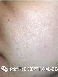 https://mmbiz.qpic.cn/mmbiz_jpg/XIo5icAdibUPKwD5ibZGXGyqYY6vlibpGJtPoCgXKXqAPibZicdUIYkOWI7LGEuOc2QCIVJraClK7LlUVJJ5iaFQGrdEg/640?wx_fmt=jpeg