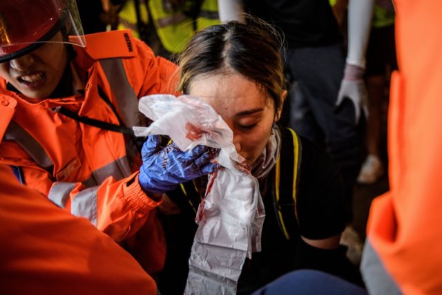 一名女性示威者的右眼疑遭警察开枪射伤。(ANTHONY WALLACE/AFP/Getty Images)