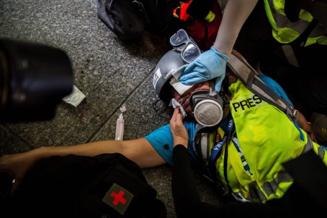 印尼女記者Veby Mega Indah在採訪反送中運動中遭警察射傷眼球造成永久失明（圖片來源： ISAAC LAWRENCE/AFP/Getty Images）